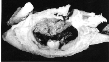 MANDIBLE
